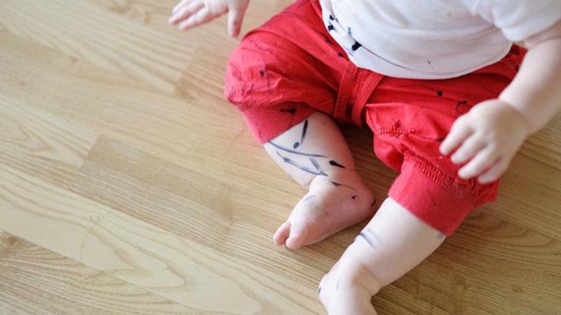 Permanent marking stains on the body